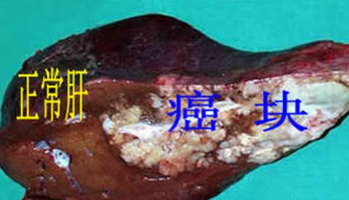 水污染與癌癥高發(fā)區(qū)必備這款儀器